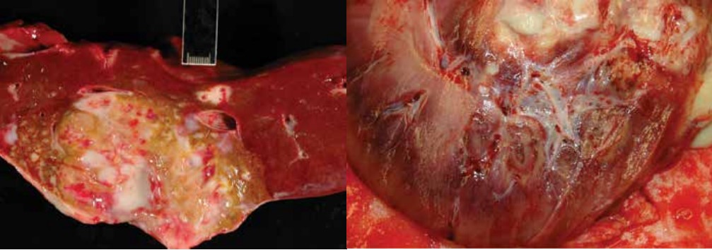 Internal abscessation in horses due to pigeon fever: Internal abscess in the liver (left) and internal abscess in the kidney (right).